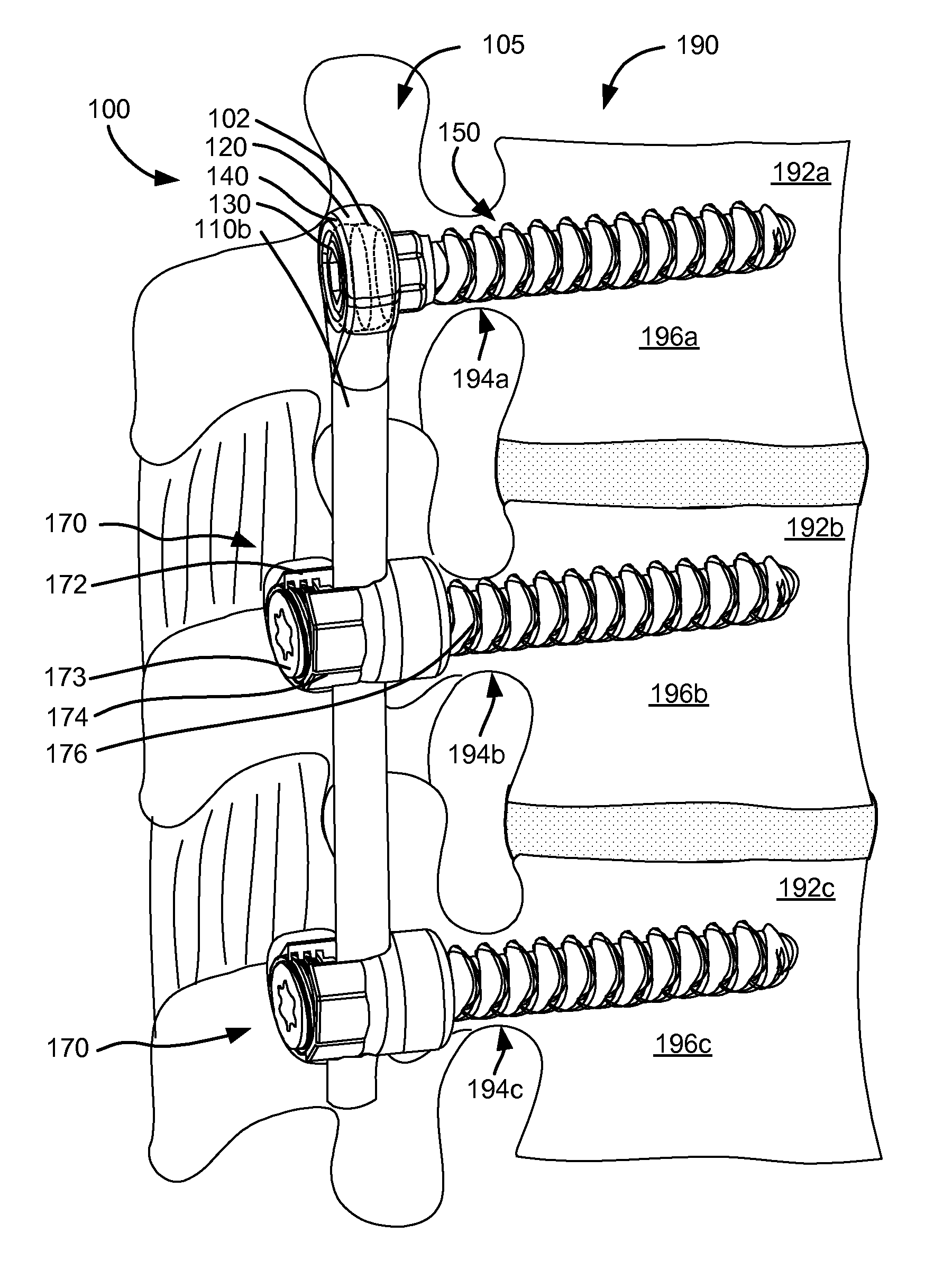 Adaptive spinal rod and methods for stabilization of the spine