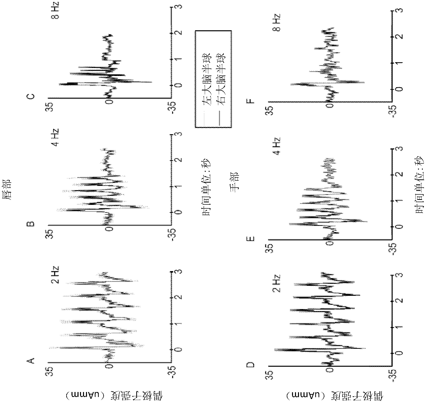 Device, system, and method for mechanosensory nerve ending stimulation