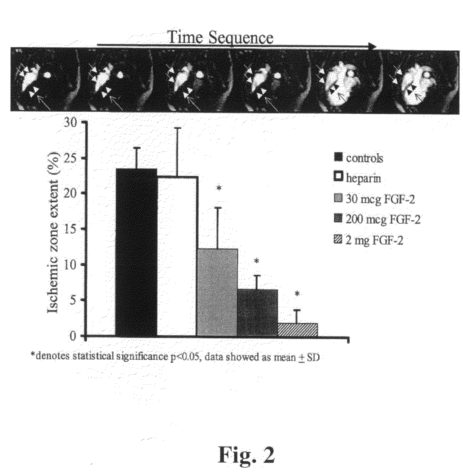 Combination growth factor therapy and cell therapy for treatment of acute and chronic diseases of the organs