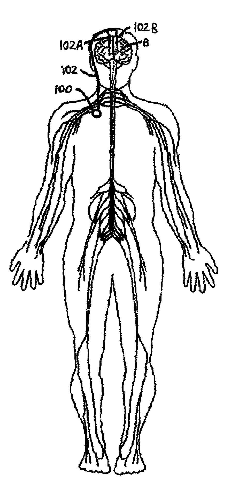 Optical communication of neurostimulation-system information