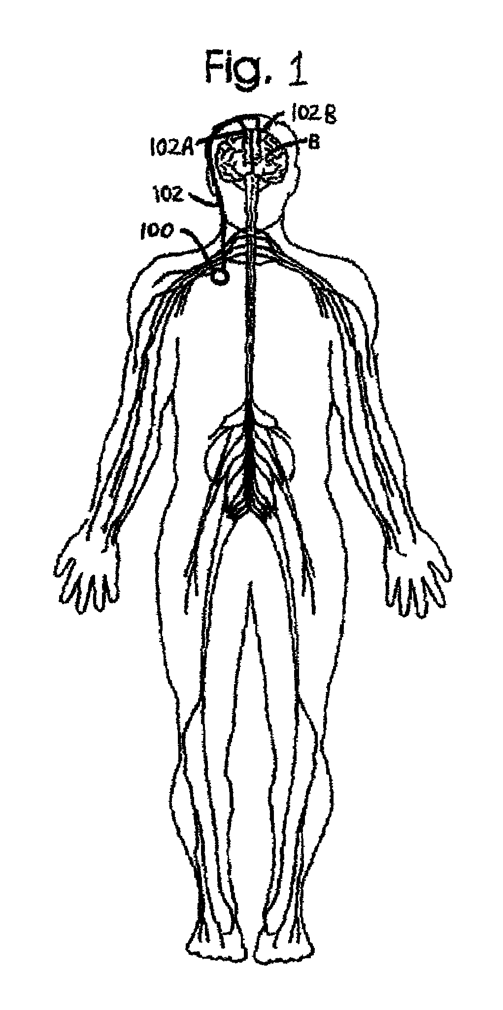 Optical communication of neurostimulation-system information