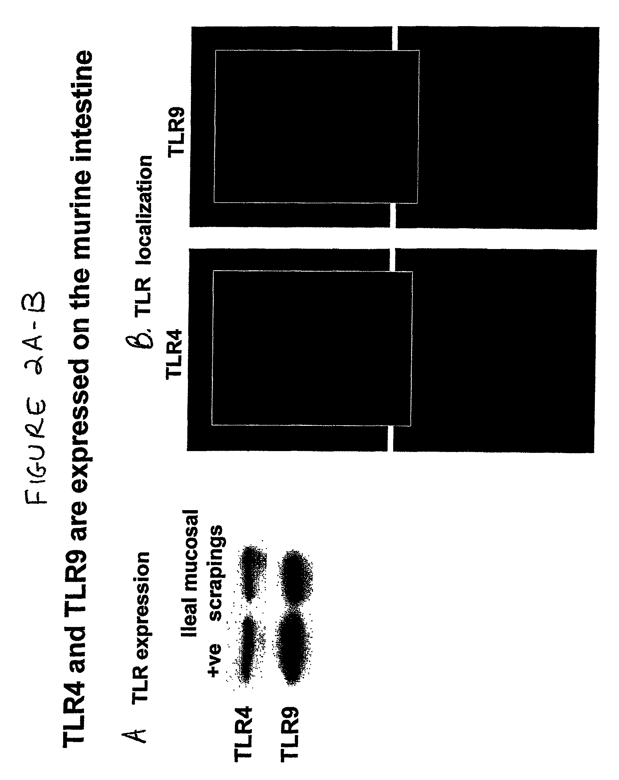 Use of toll-like receptor-9 agonists, toll-like receptor-4 antagonists, and/or nuclear oligomerization domain-2 agonists for the treatment or prevention of toll-like receptor-4-associated disorders