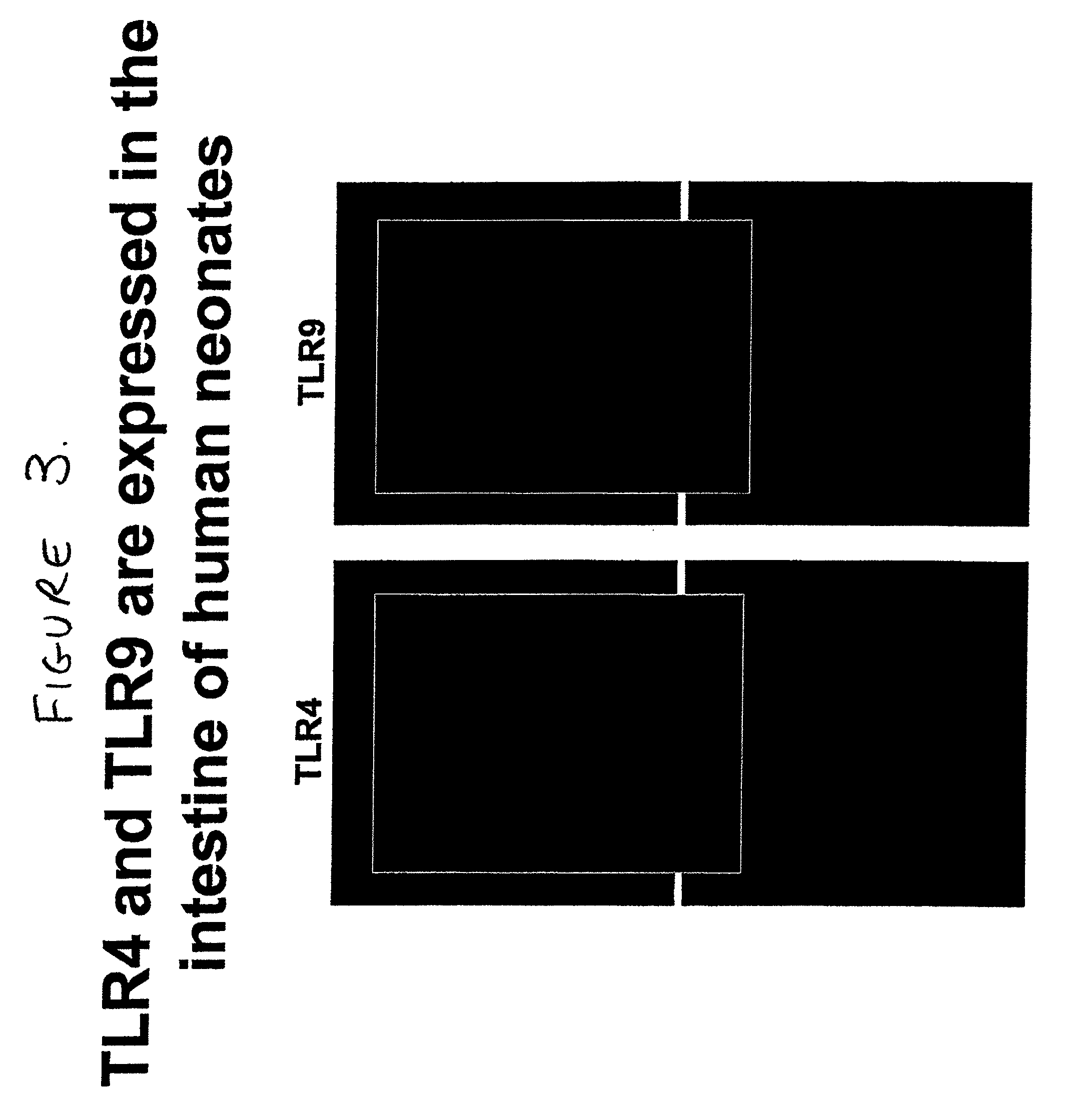 Use of toll-like receptor-9 agonists, toll-like receptor-4 antagonists, and/or nuclear oligomerization domain-2 agonists for the treatment or prevention of toll-like receptor-4-associated disorders