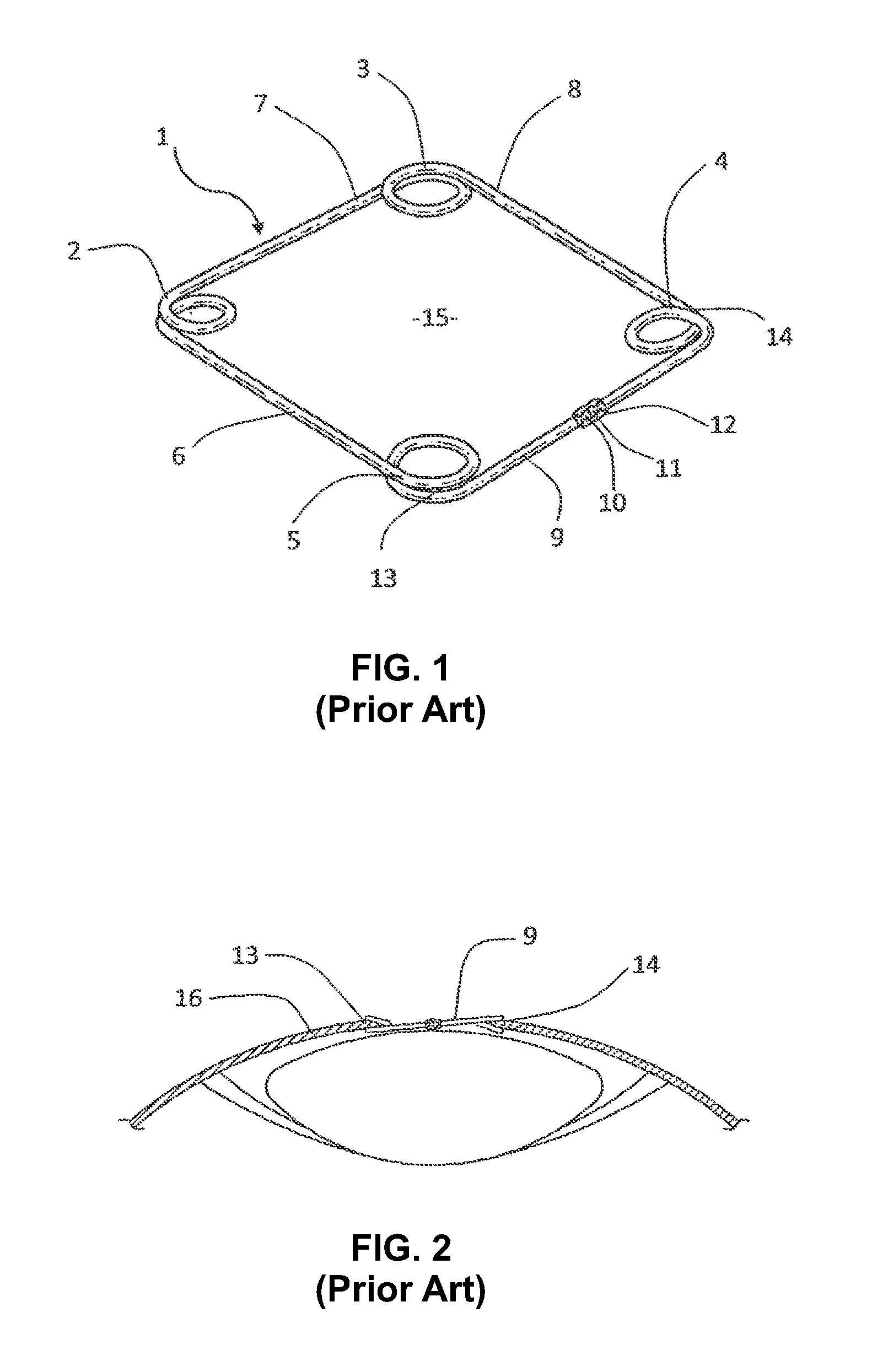 Pupil expansion device