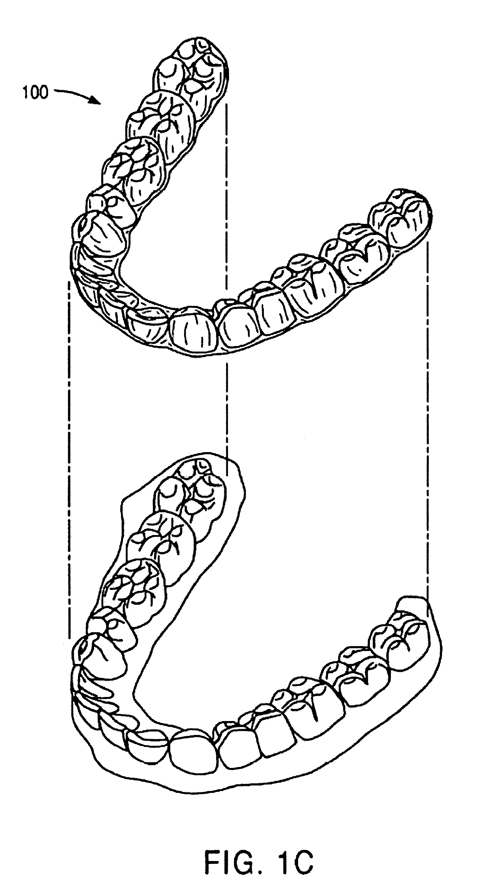 Methods and systems for treating teeth