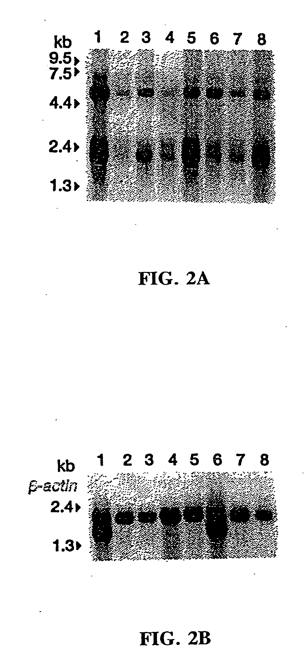 Methylthioadenosine phosphorylase compositions and methods of use in the diagnosis and treatment of proliferative disorders