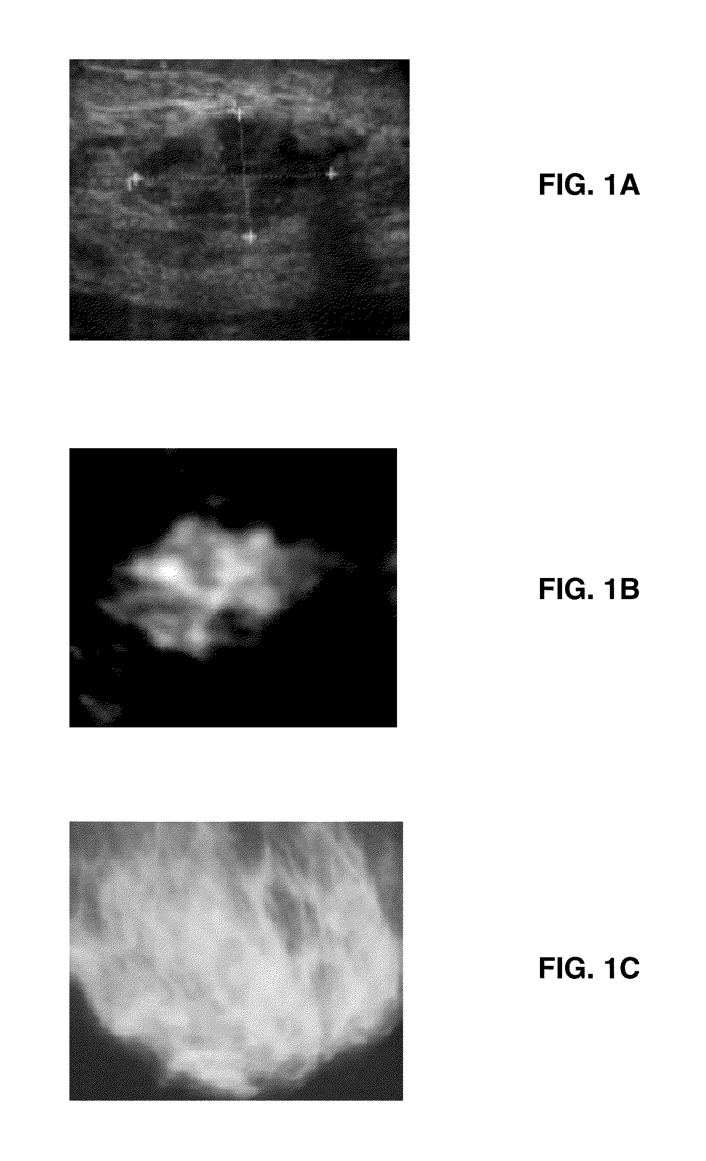 Laser Optoacoustic Ultrasonic Imaging System (LOUIS) and Methods of Use