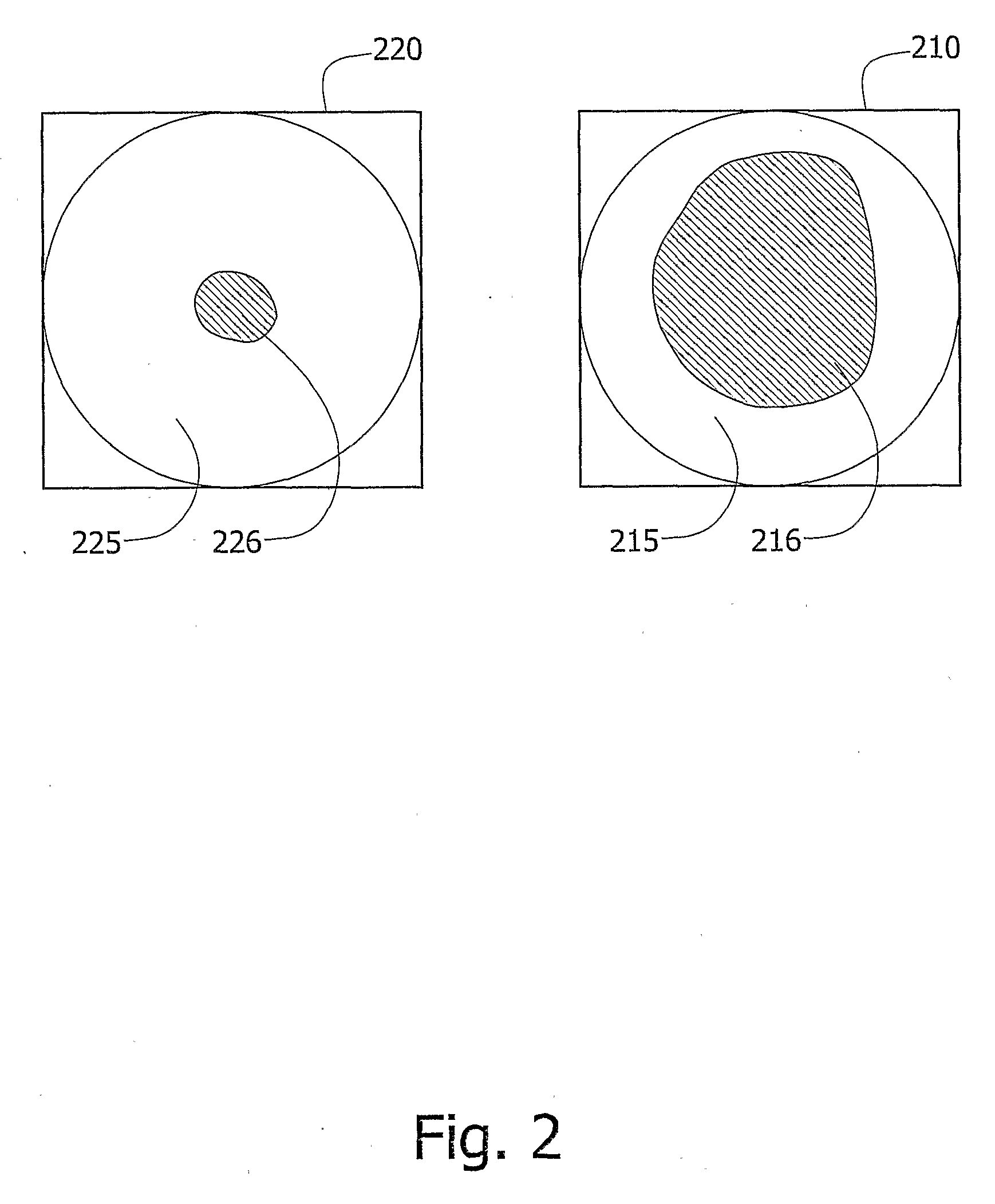 Device, system and method for measurement and analysis of contractile activity