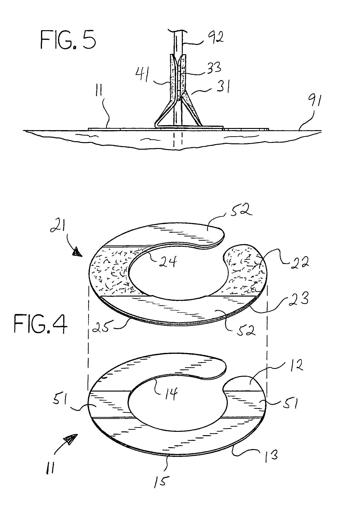 Slotted catheter securement device