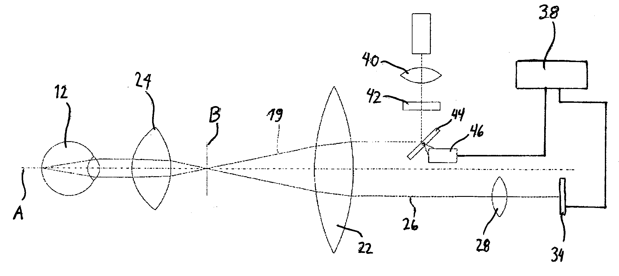 Ophthalmoscope