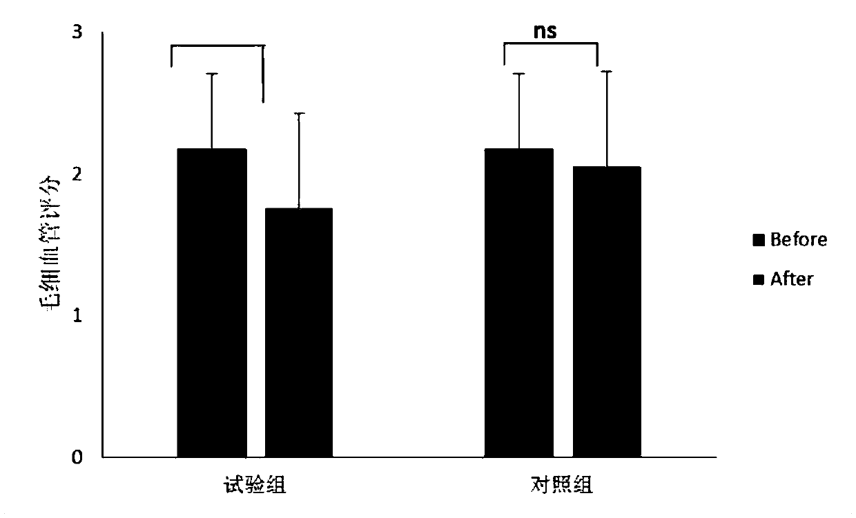 Couperose skin improving composition, compound preparation and preparation method thereof