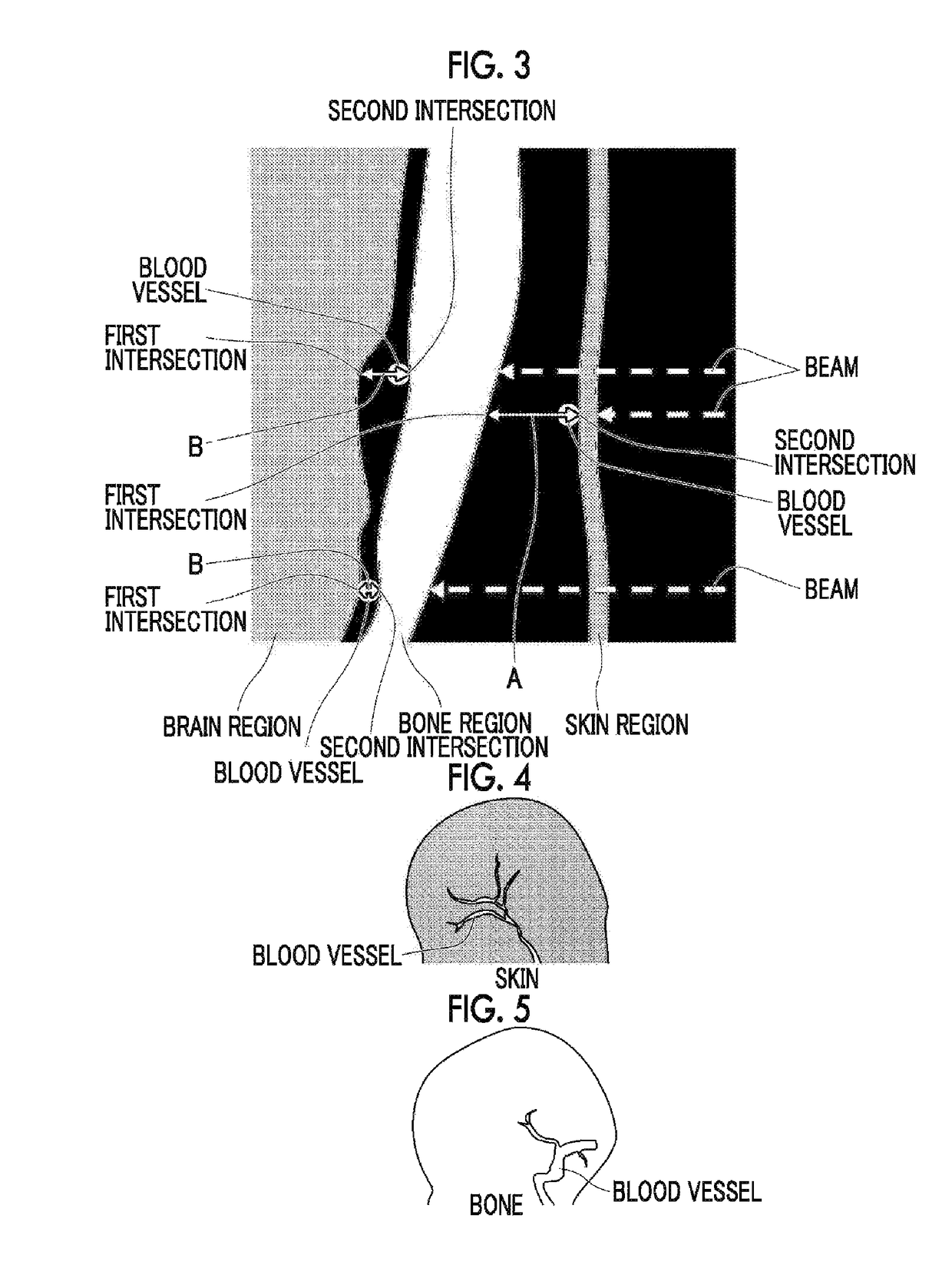 Medical image display control device, method of operation for same, and medical image display control program