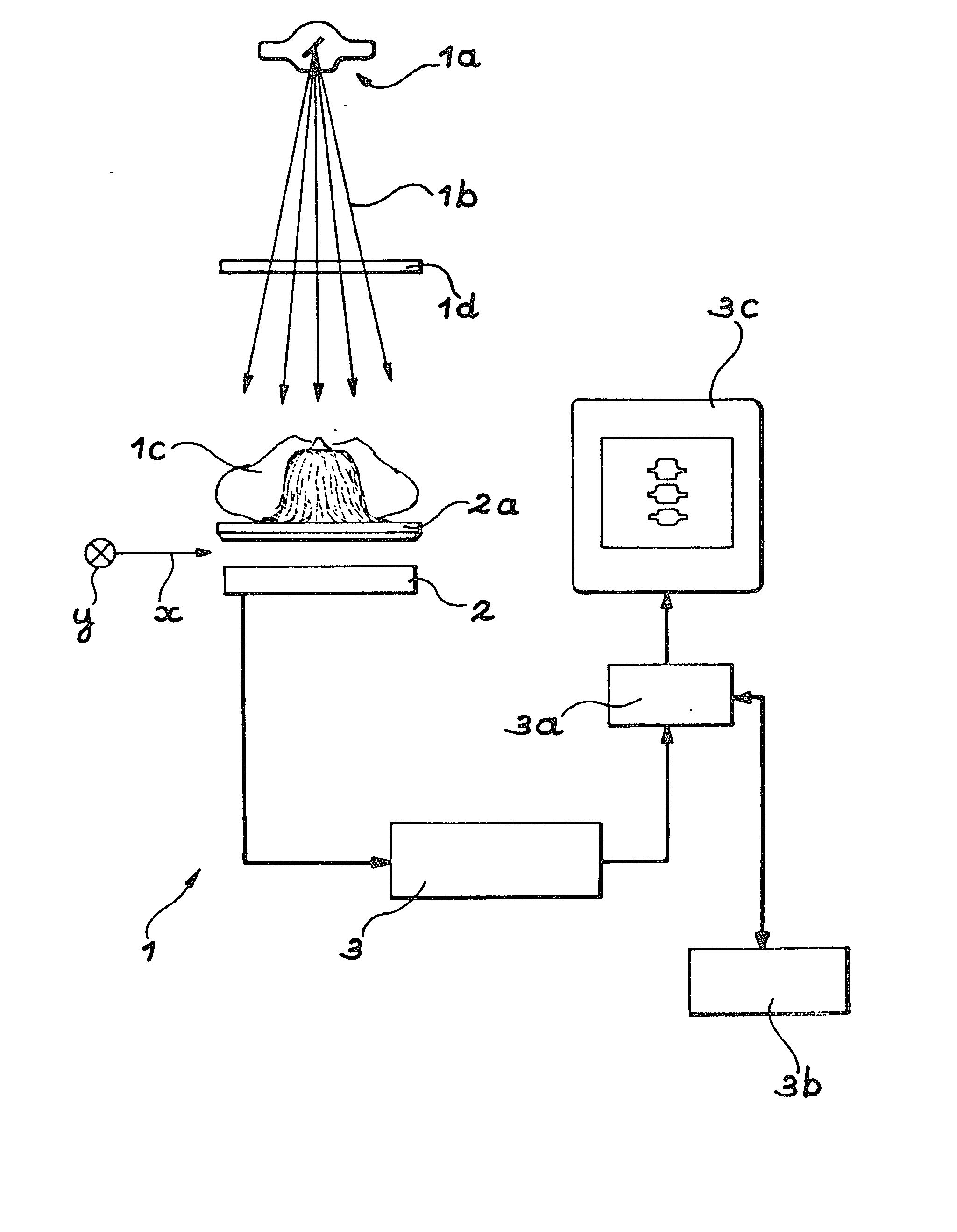 Method for using a bone densitometry system,with dual-energy x-radiation