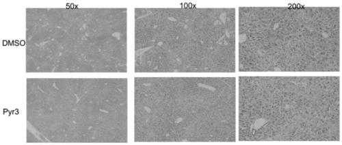 Application of Pyr3 in preparation of medicine for protecting liver injury