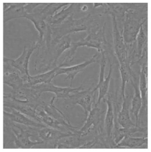 A kind of cell culture medium and its application and method for inducing dental pulp stem cells to differentiate into nerve-like cells