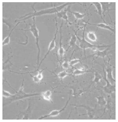 A kind of cell culture medium and its application and method for inducing dental pulp stem cells to differentiate into nerve-like cells