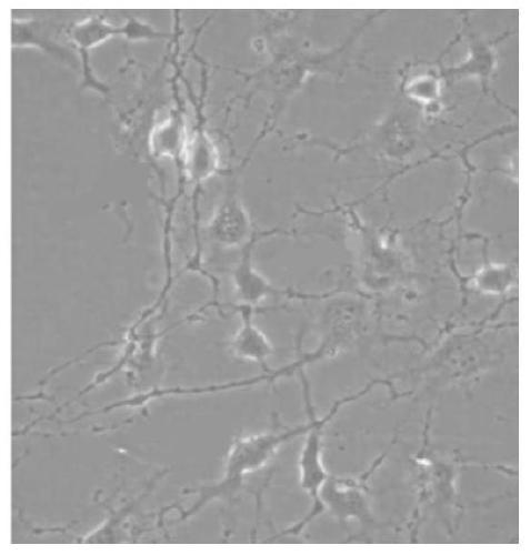 A kind of cell culture medium and its application and method for inducing dental pulp stem cells to differentiate into nerve-like cells