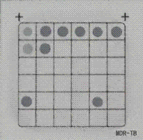 Mycobacterium tuberculosis drug-resistant mutant gene detection kit