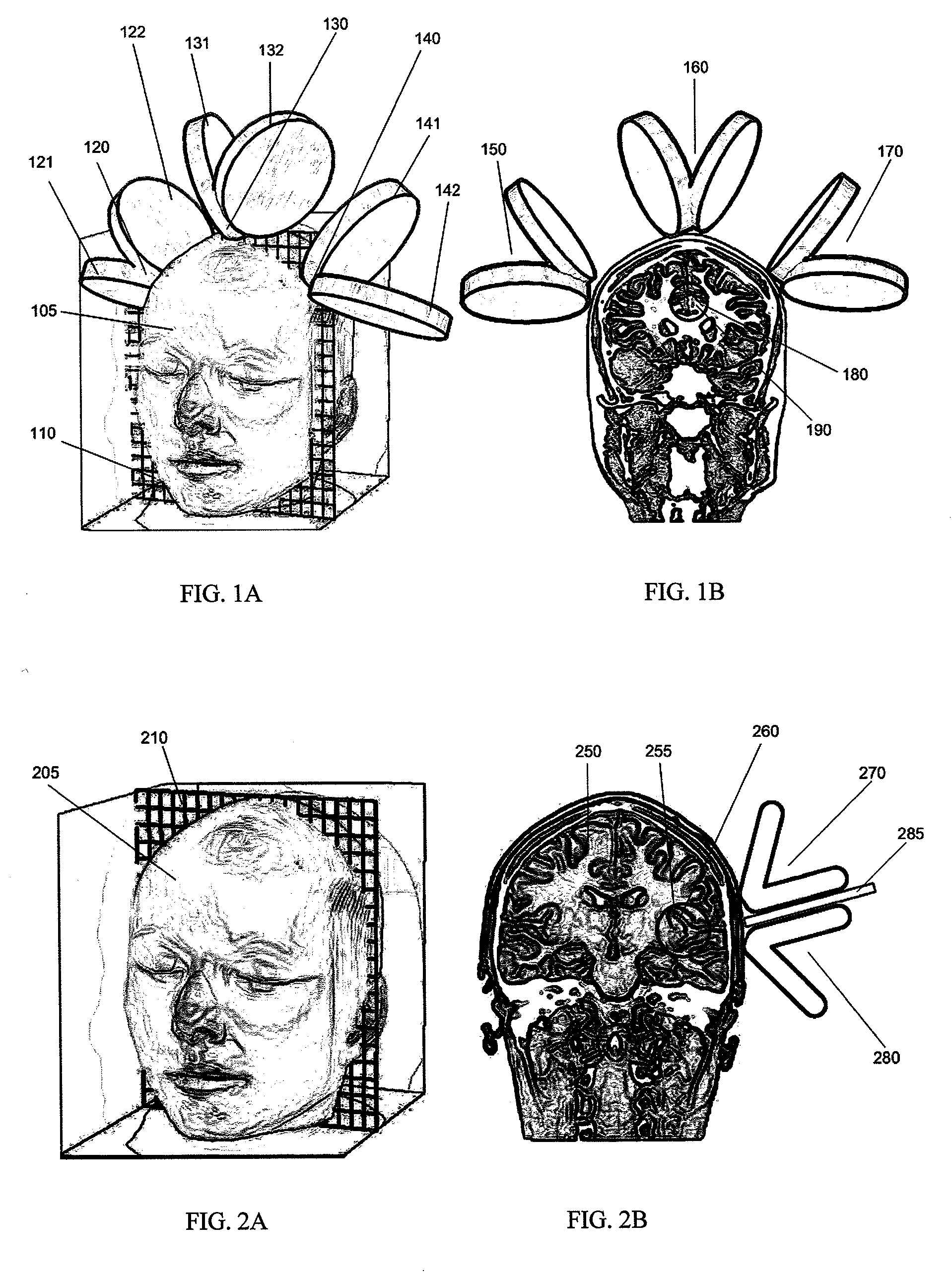 Transcranial magnet stimulation of deep brain targets