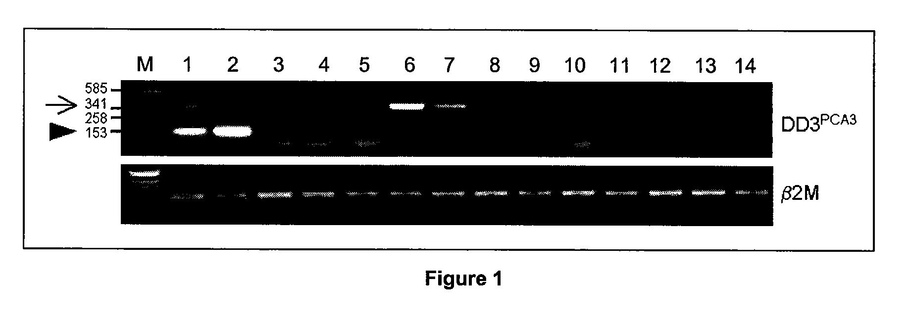 Specific method of prostate cancer detection based on pca3 gene, and kits therefor