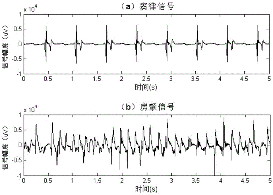 Frequency domain correlation analysis method for cardiac mapping signals