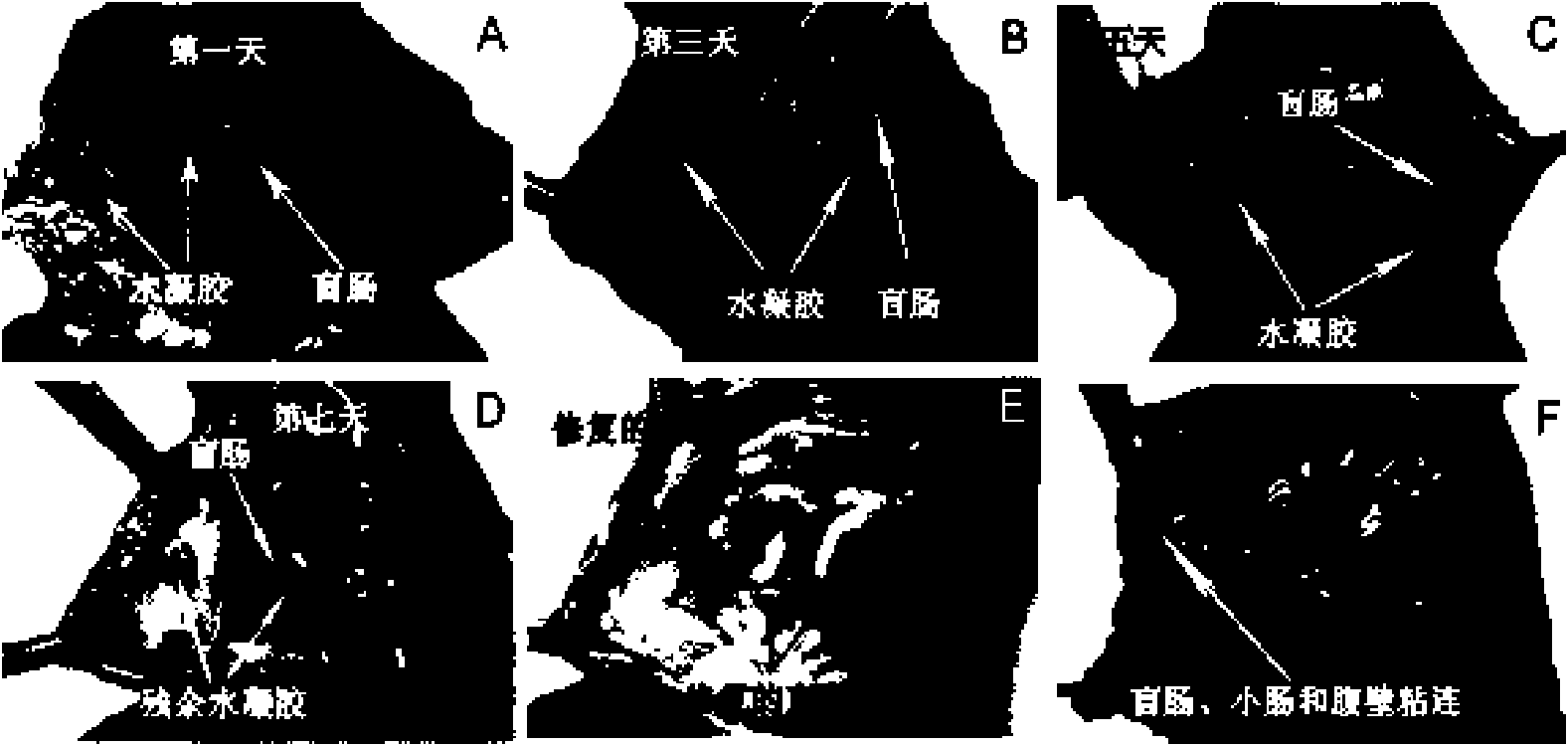 Application of PEG-PCL-PEG triblock copolymer in preparation of medical anti-adhesion material