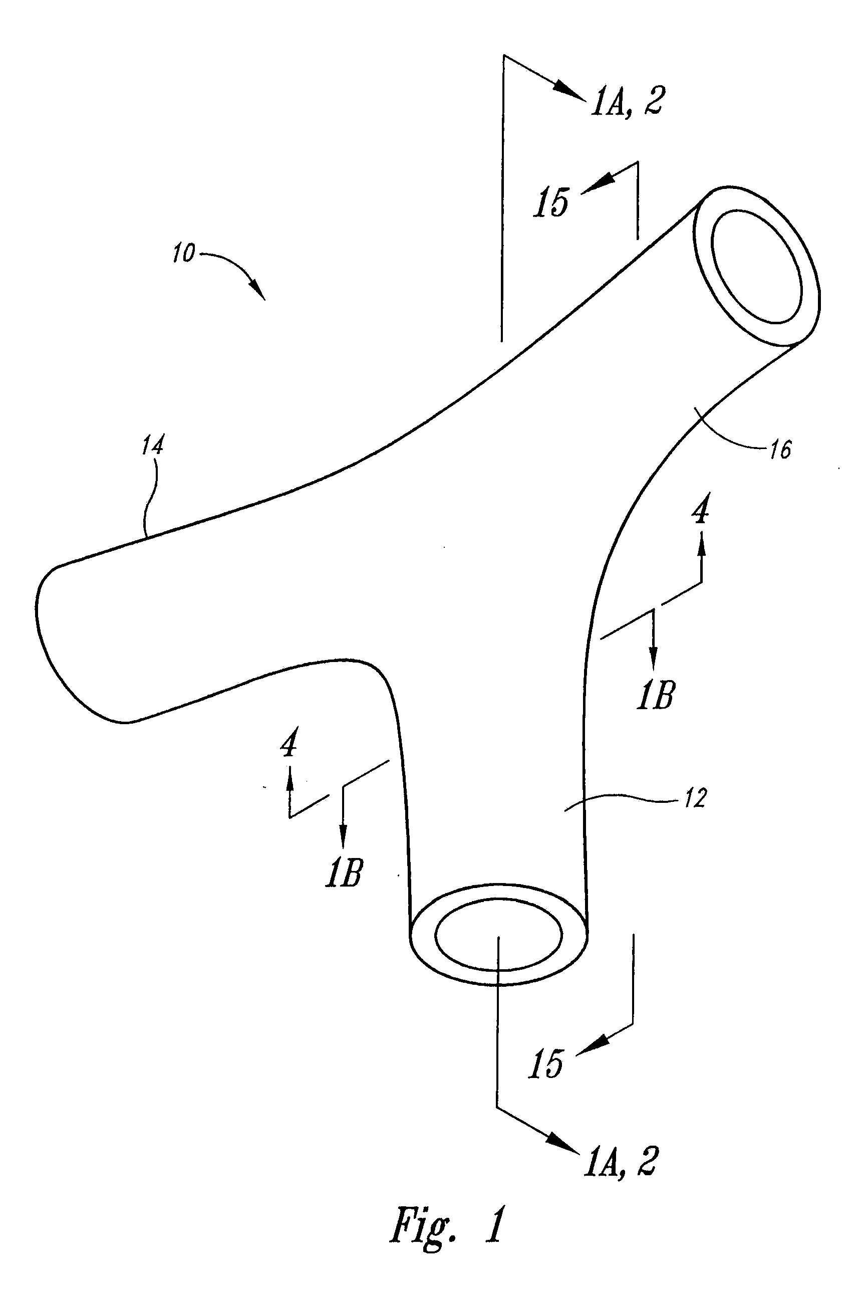 Vascular anchoring system and method