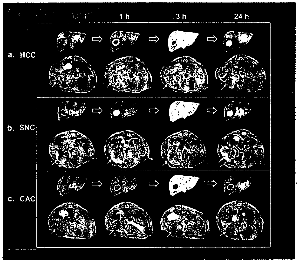 Diagnostic imaging hepatic tissue-specific contrast medium comprising manganese silicate nanoparticle