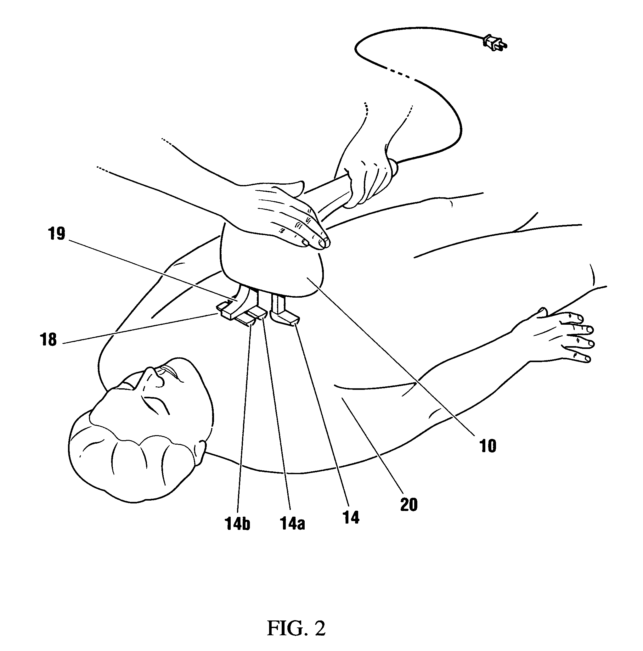 Automatically adjusting contact node for multiple rib space engagement