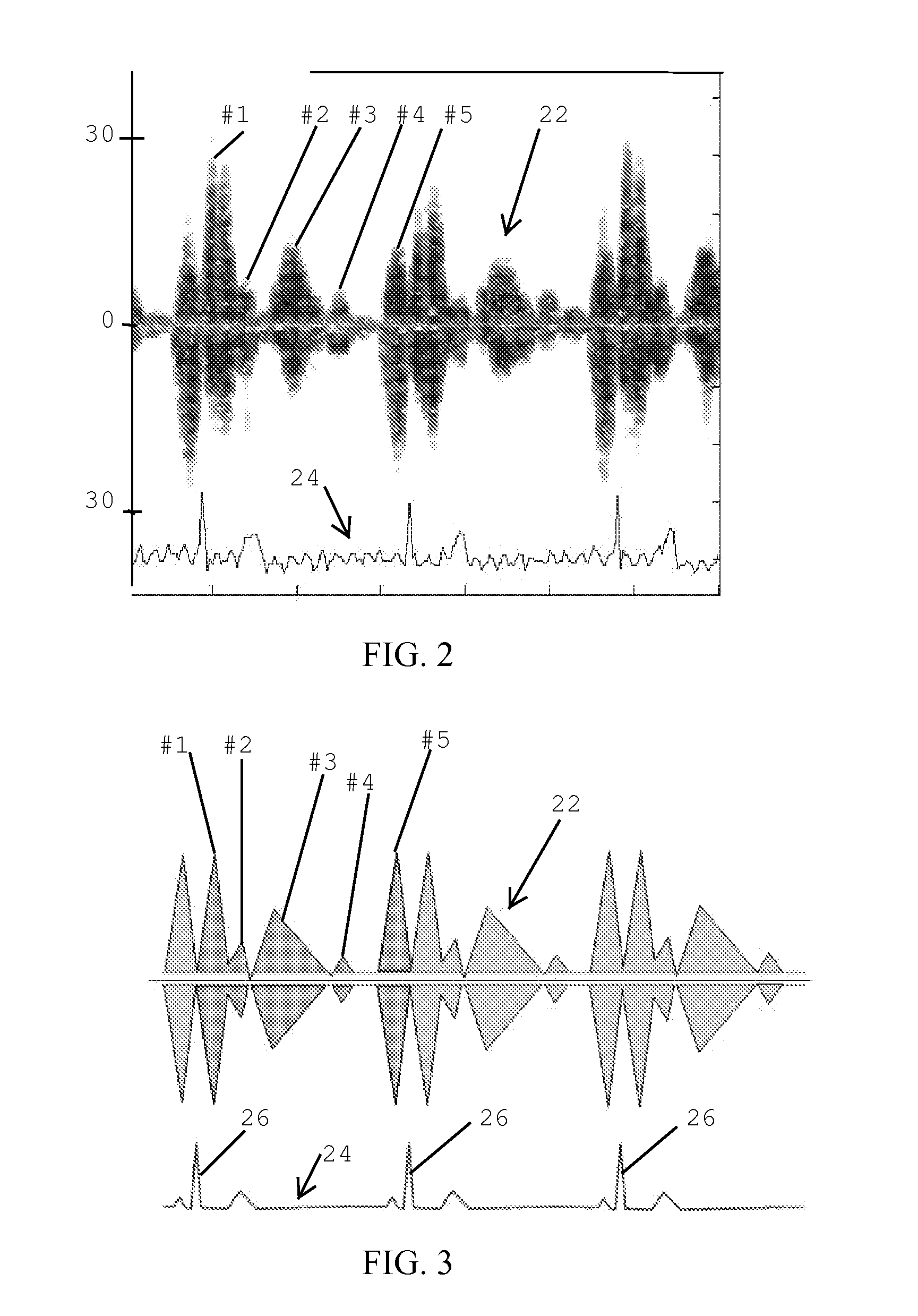 Transthoracic Cardio-Pulmonary Monitor