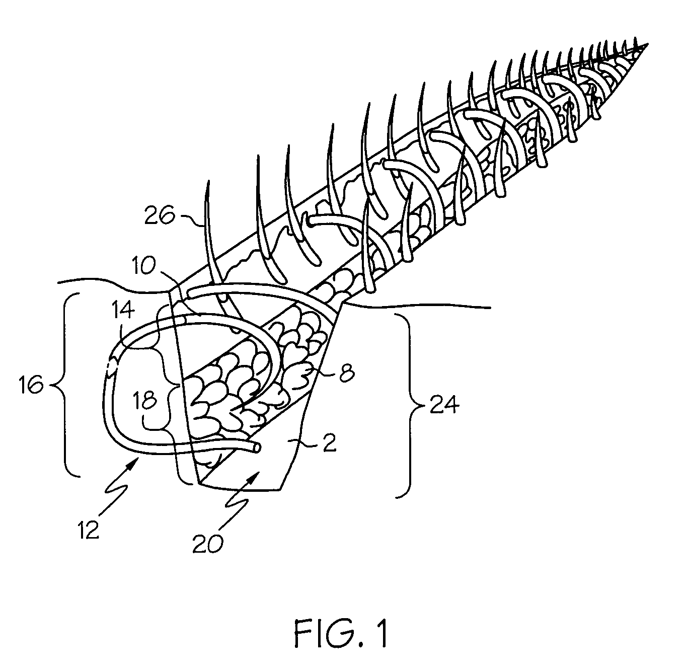 Gold suture and method of use in wound closure