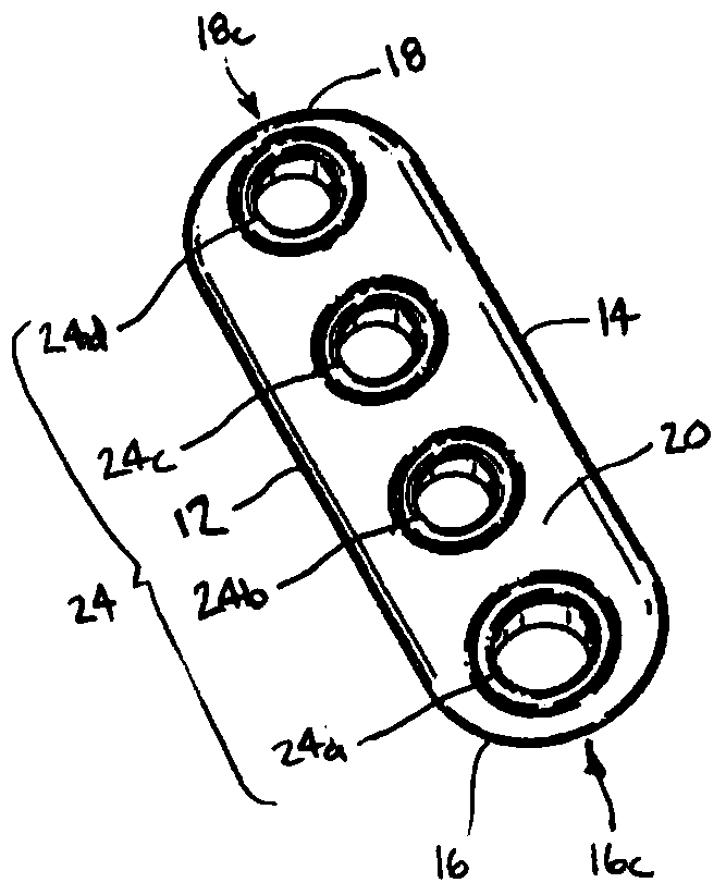 Implant with filament extension of adjustable loop disposed in shuttle suture