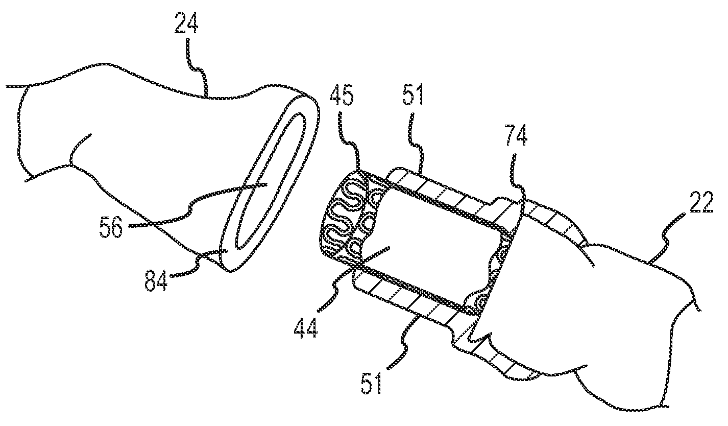 Methods and apparatus for surgical anastomosis