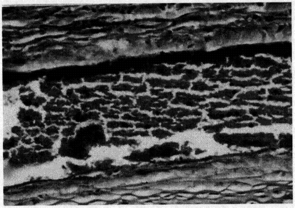 Calf blood deproteinized extract composition and its injection and preparation method