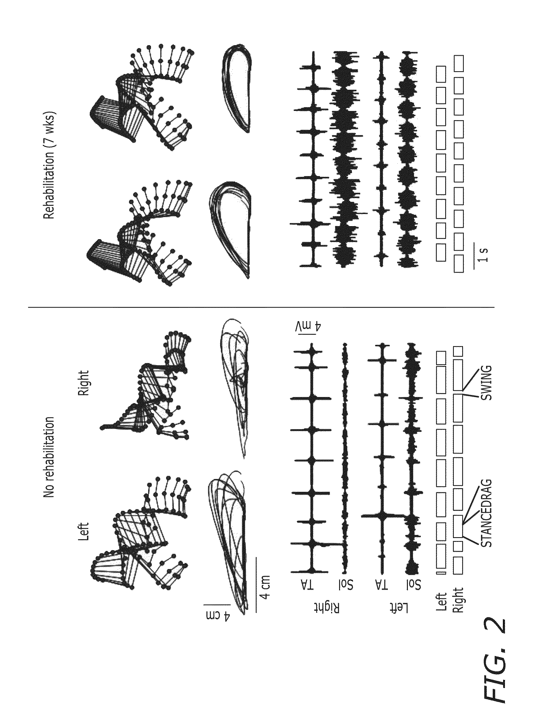 Epidural stimulation for facilitation of locomotion, posture, voluntary movement, and recovery of autonomic, sexual, vasomotor, and cognitive function after neurological injury