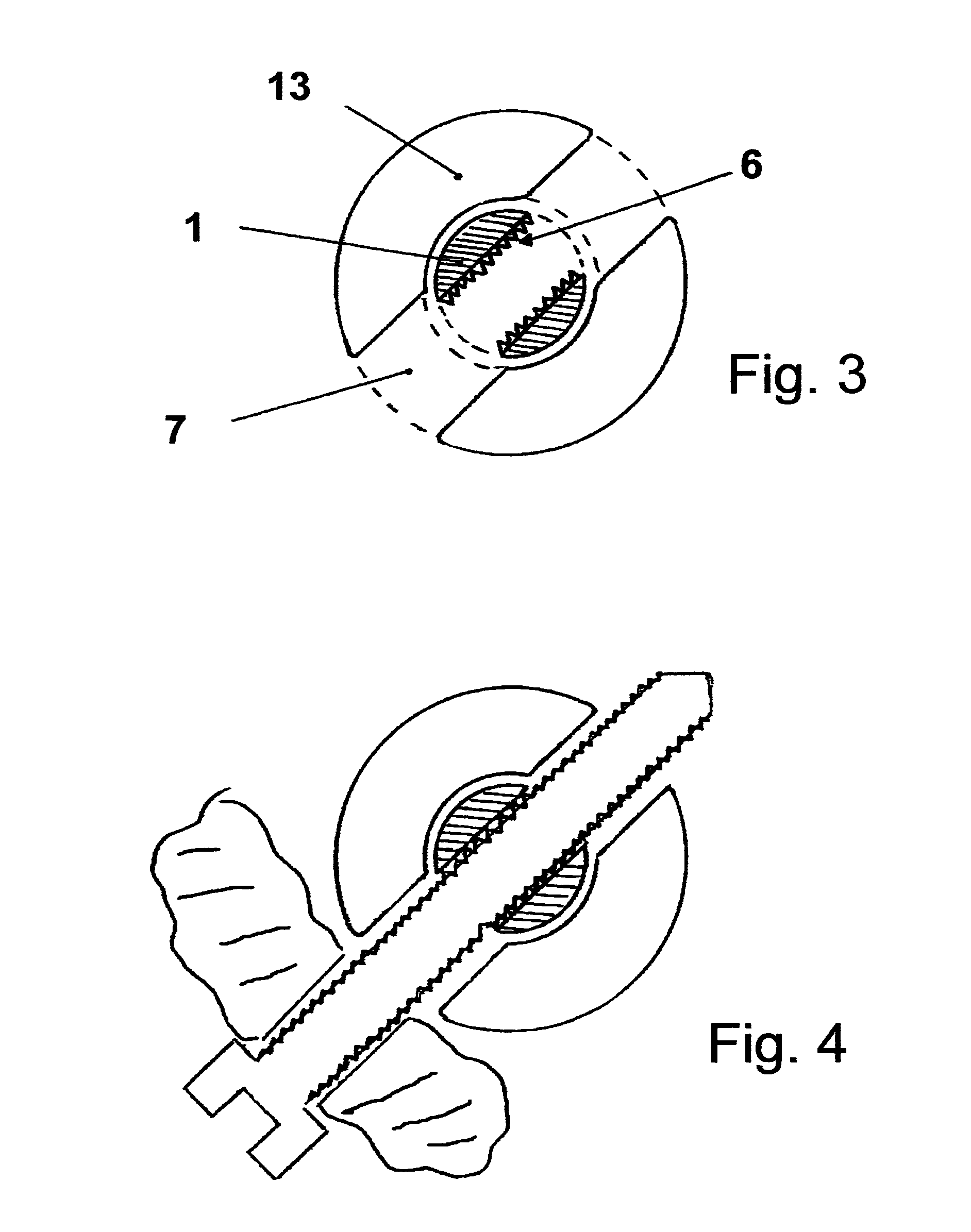 Shoulder prosthesis with insert for locking screws