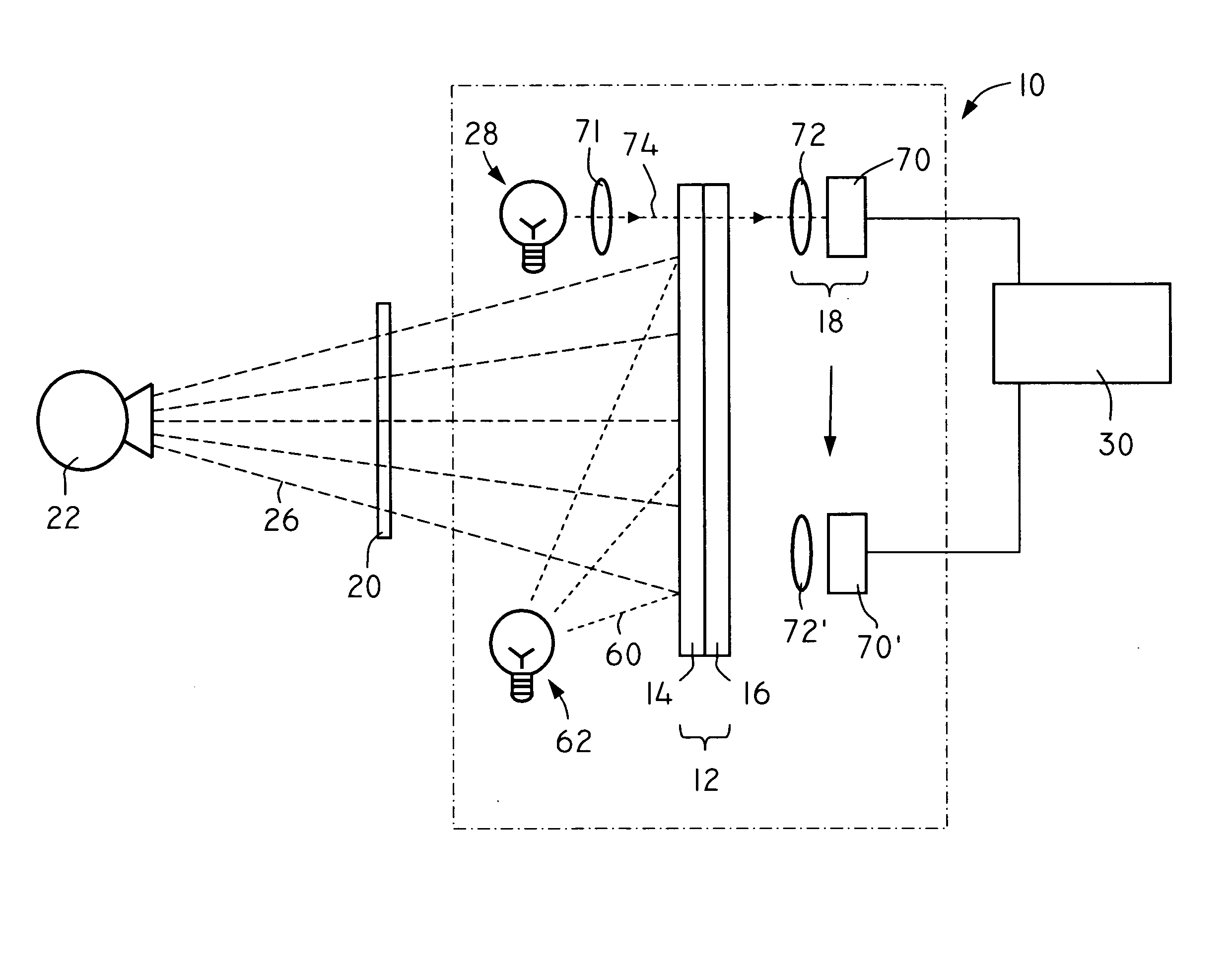 X-ray light valve based digital radiographic imaging systems