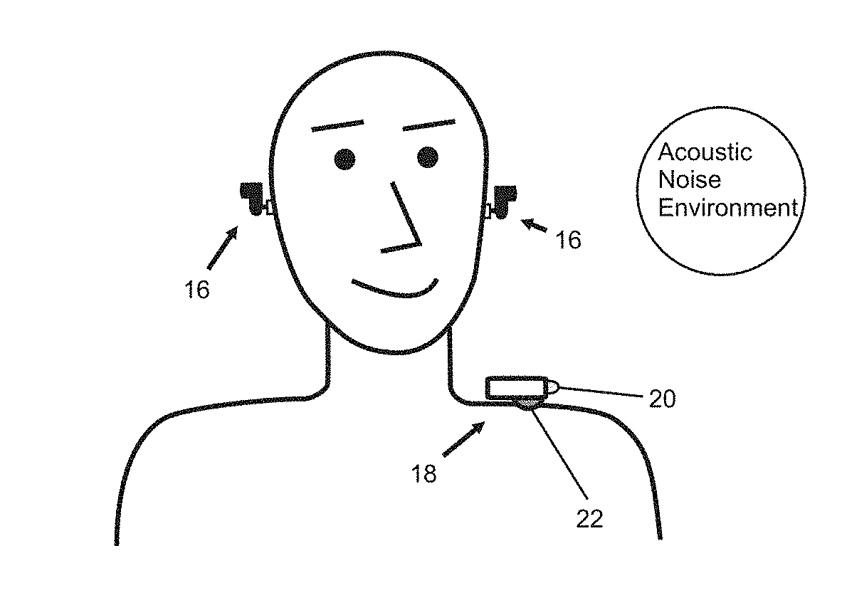 In-Ear Noise Dosimetry System