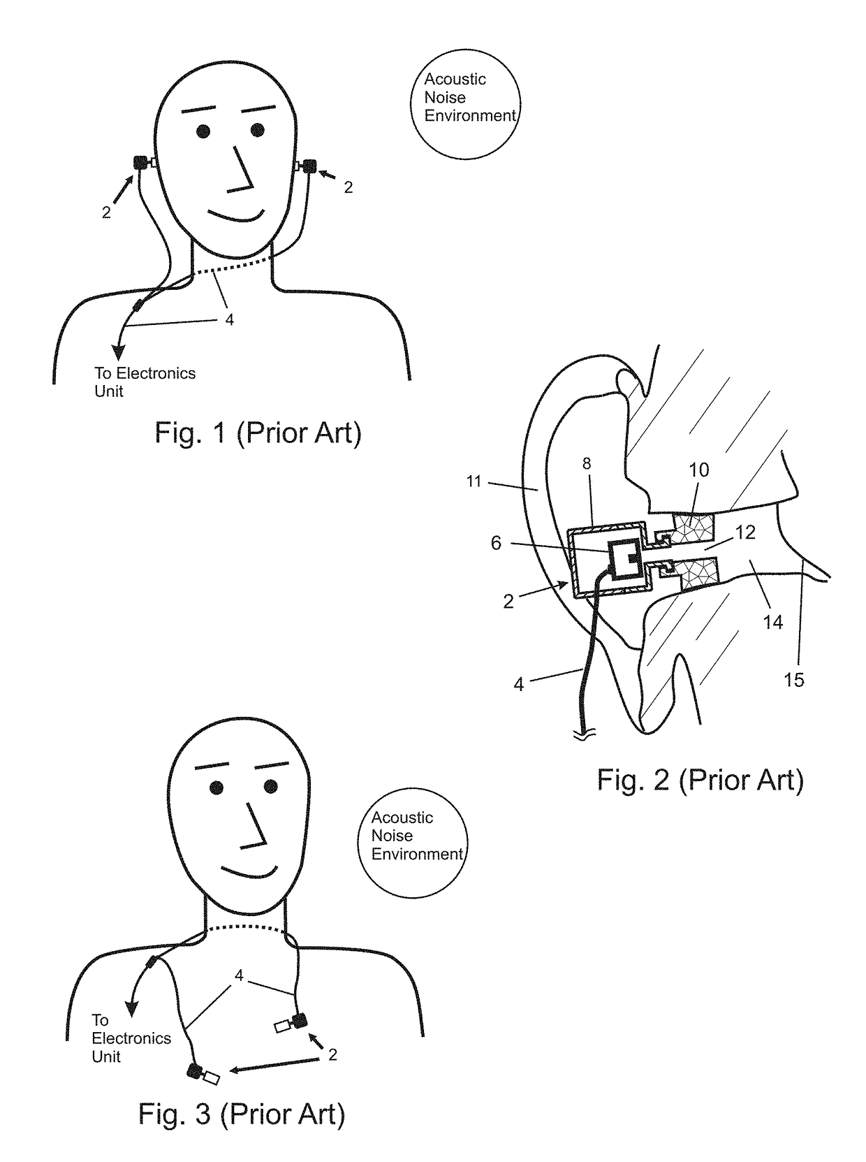 In-Ear Noise Dosimetry System