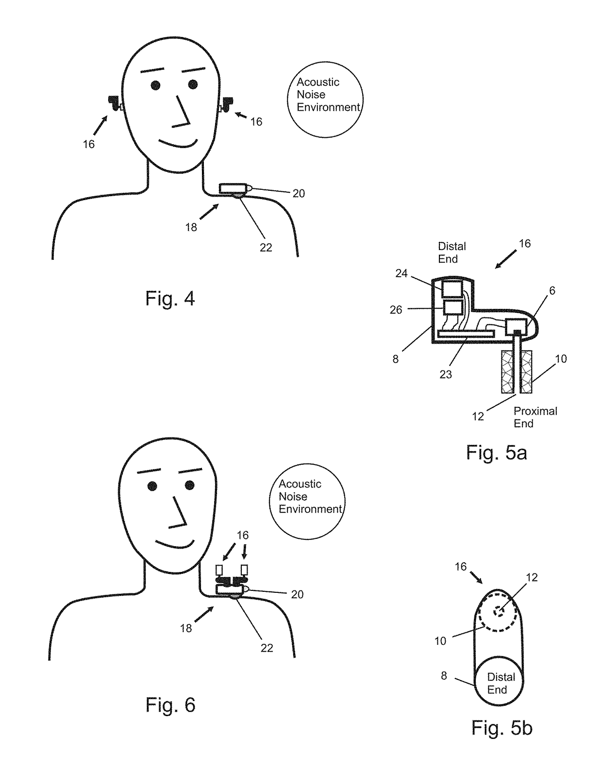 In-Ear Noise Dosimetry System