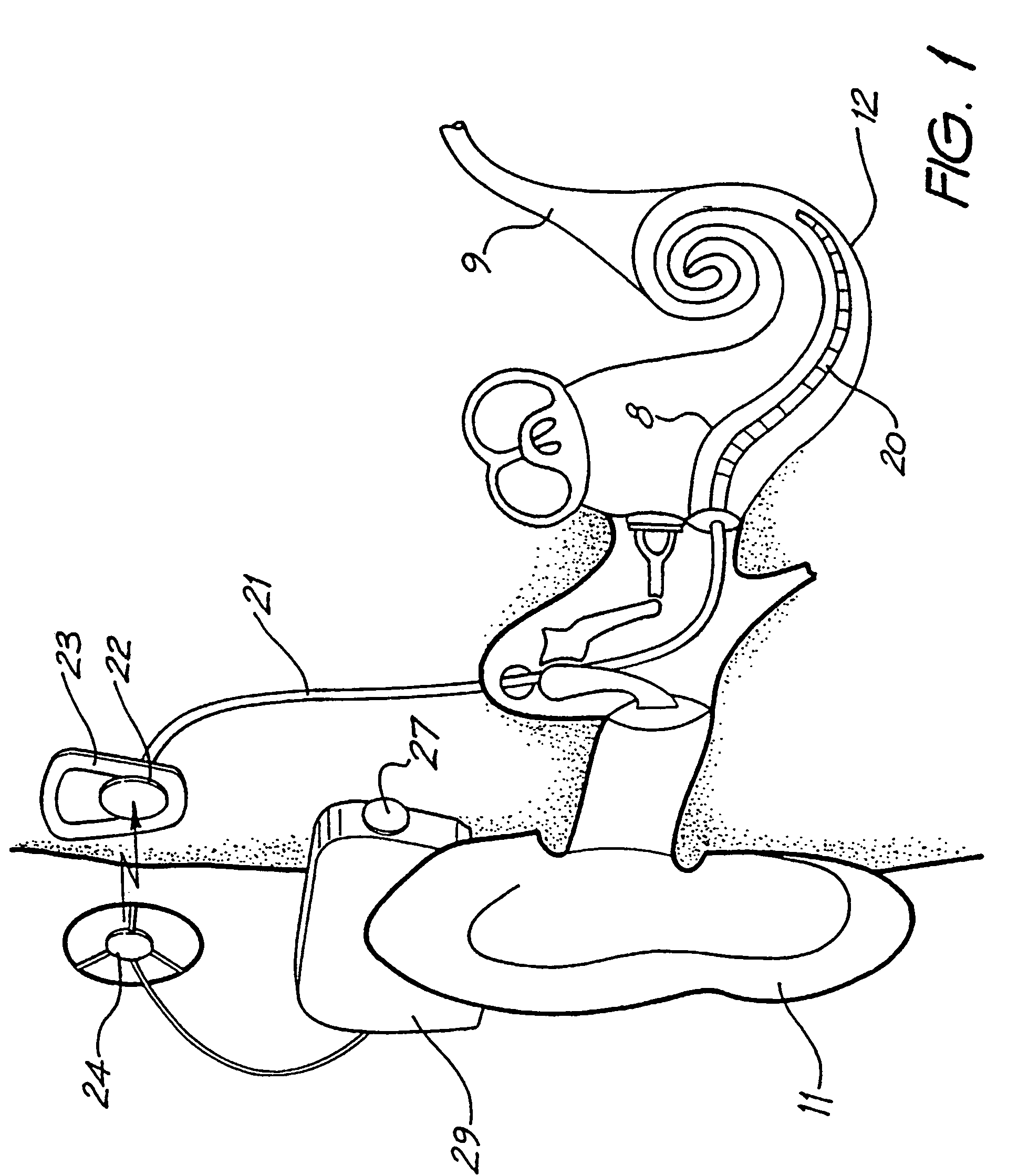 Laminated electrode for a cochlear implant