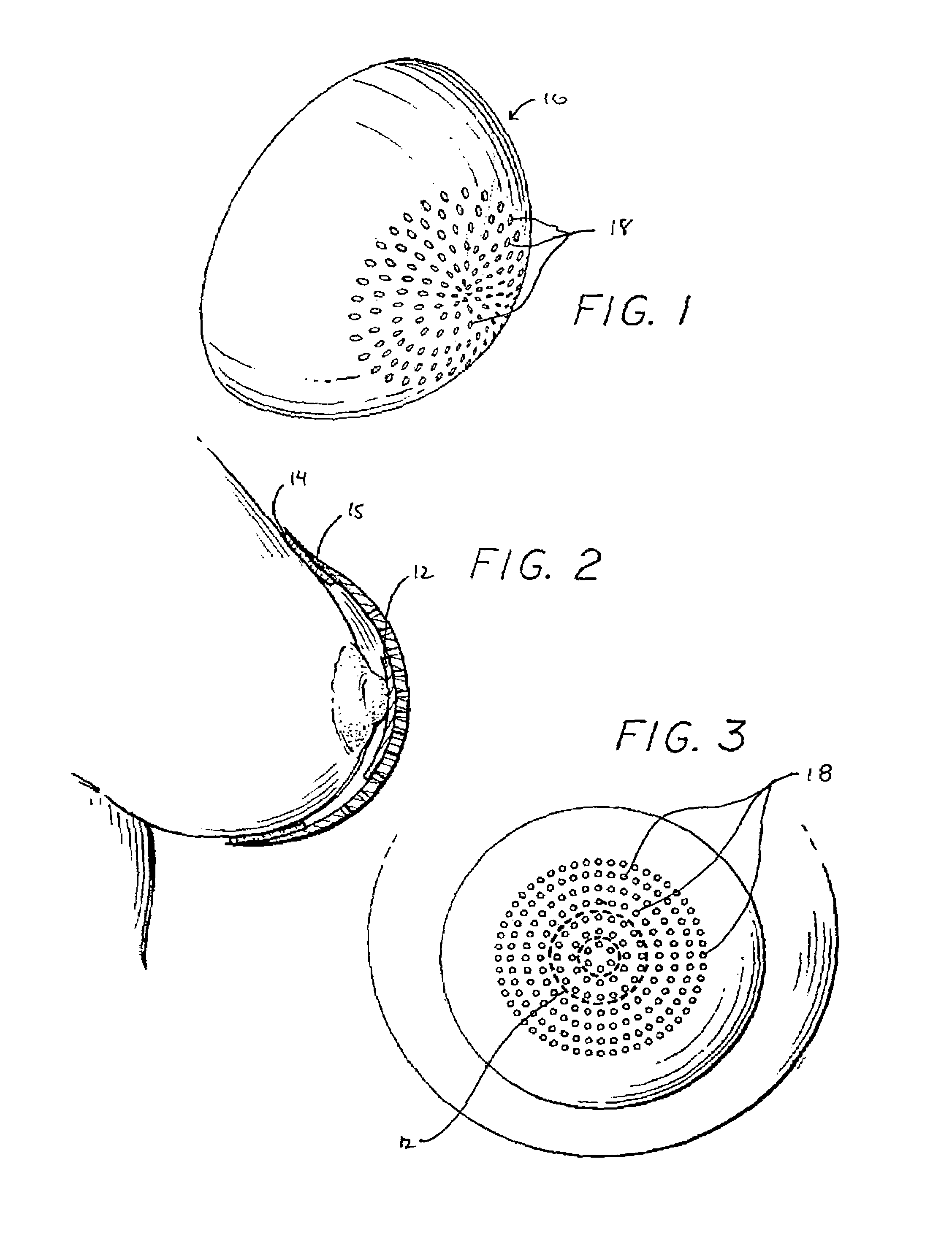 Prosthetic device