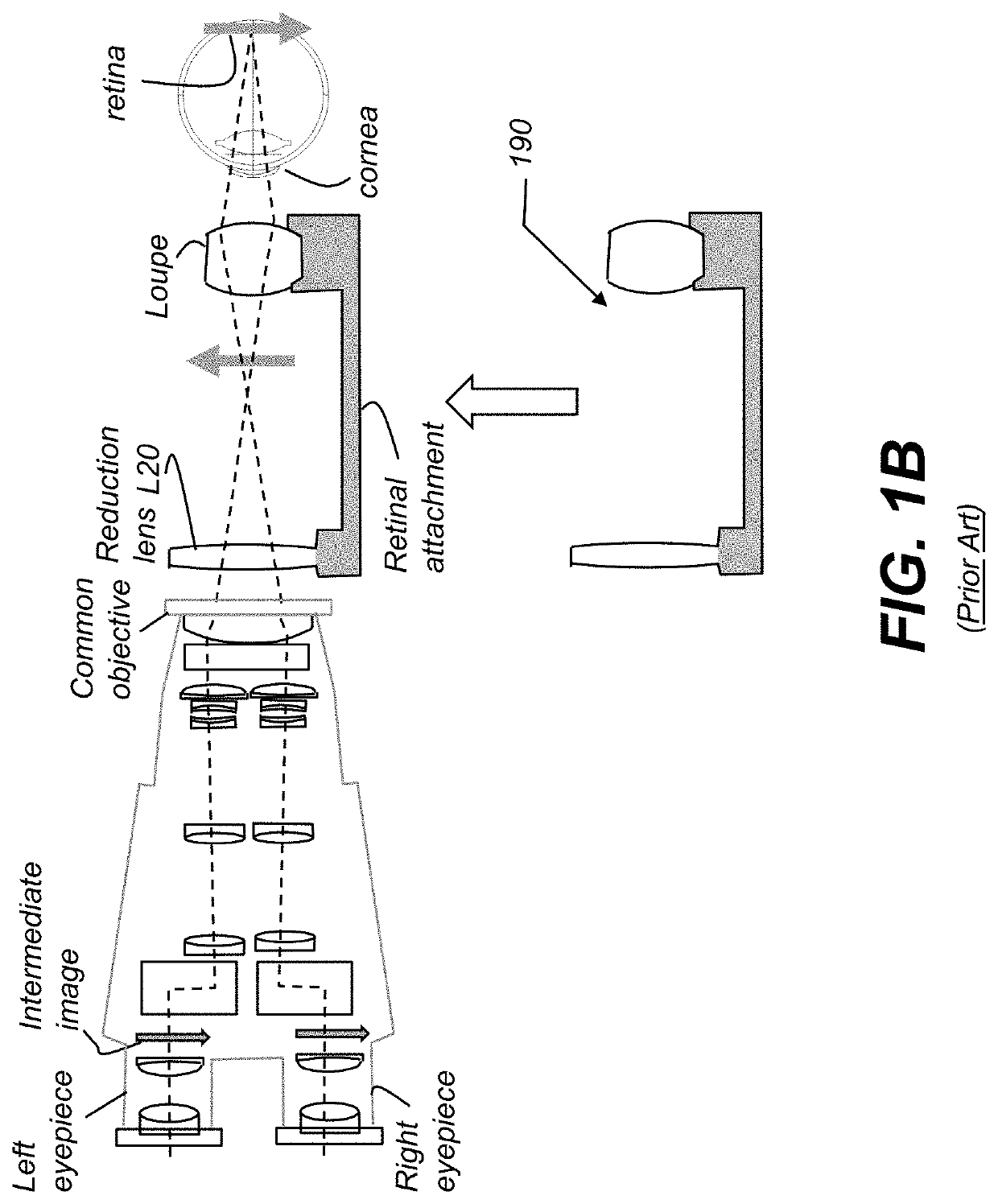 Surgery 3D Visualization Apparatus