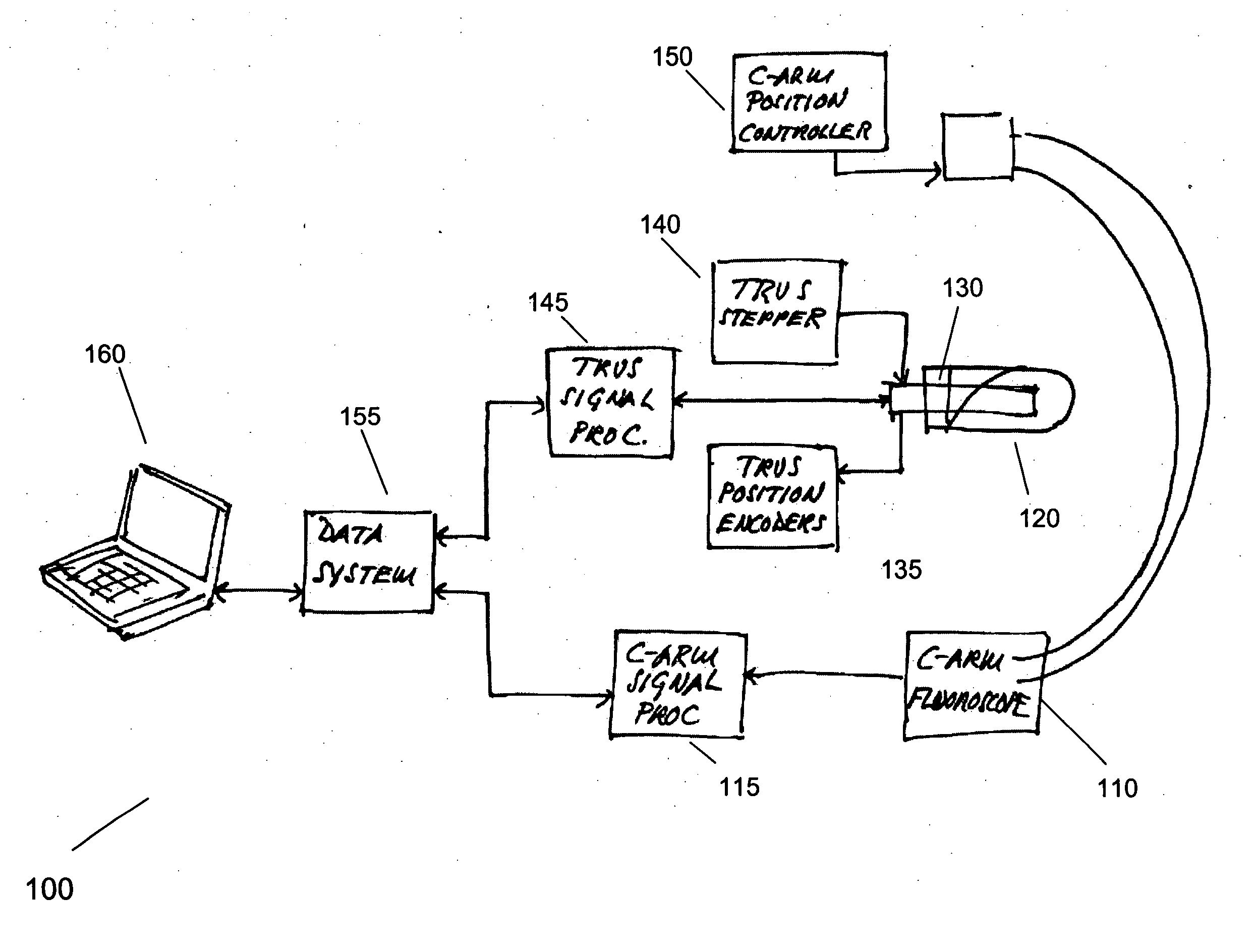 Registration of ultrasound to fluoroscopy for real time optimization of radiation implant procedures