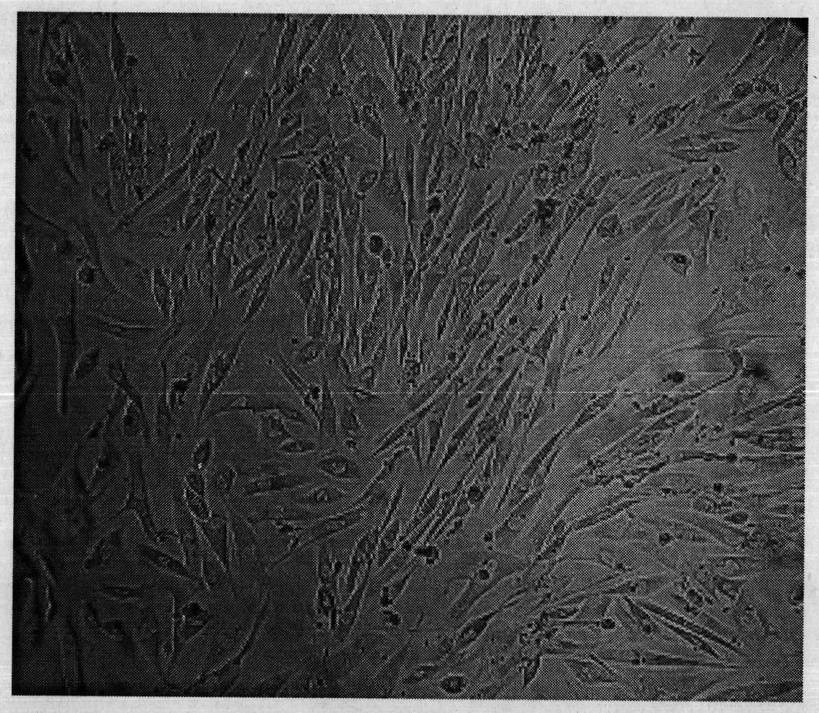 Method for culturing autologous tissue fibroblast