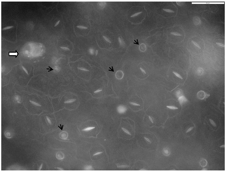 Microscopic slide preparation method for observing characteristics of lower epidermis of folium artemisiae argyi