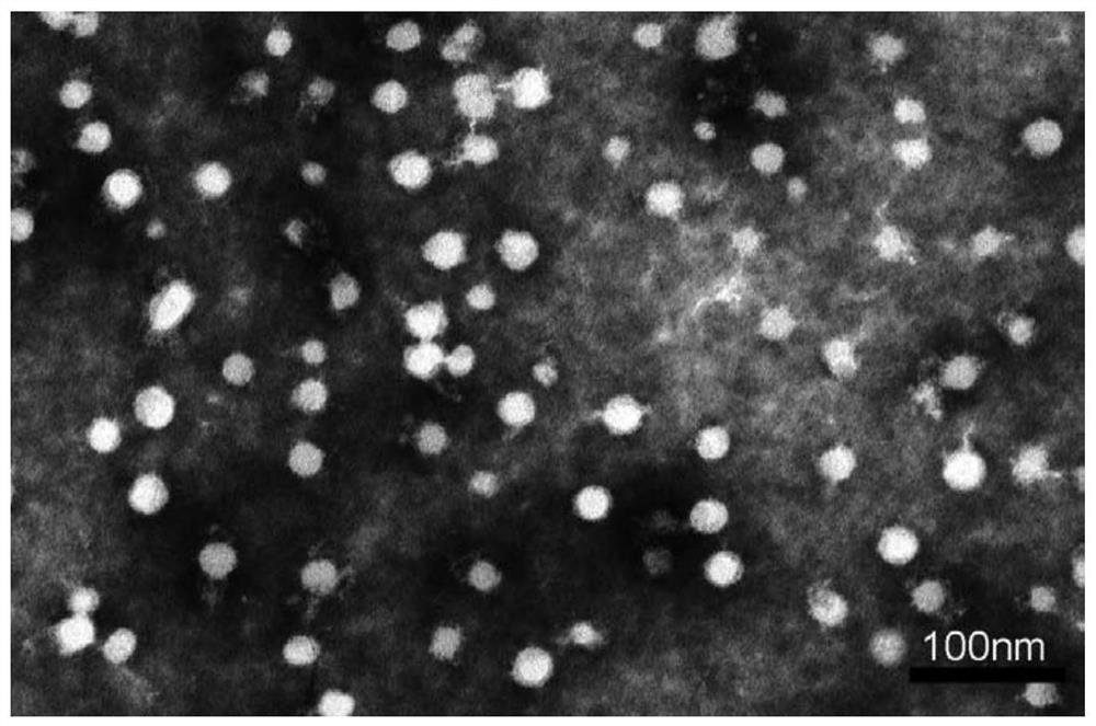 Polymer nano-micelle entrapped with two drugs and preparation method and application of polymer nano-micelle