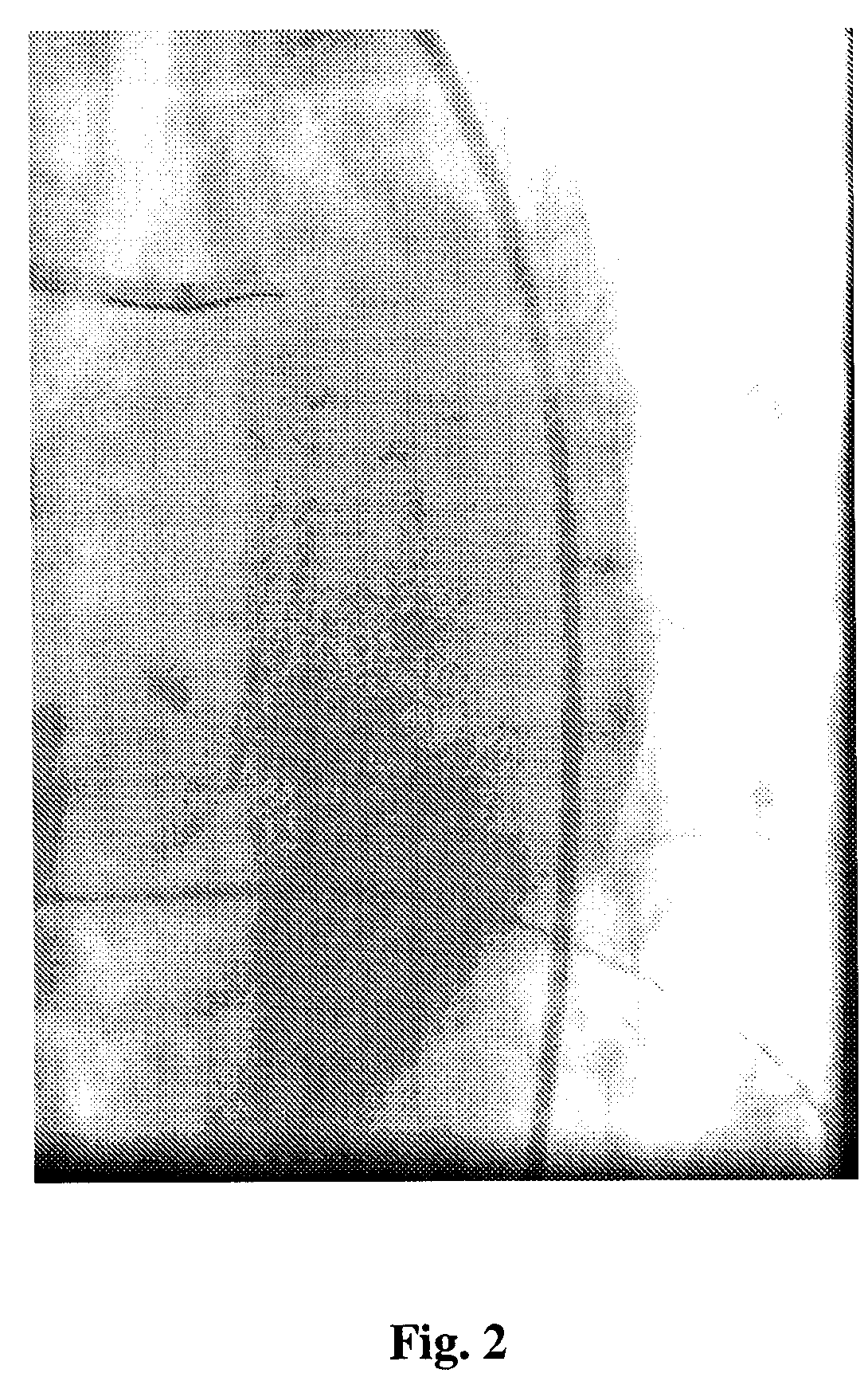 Image-based medical device localization