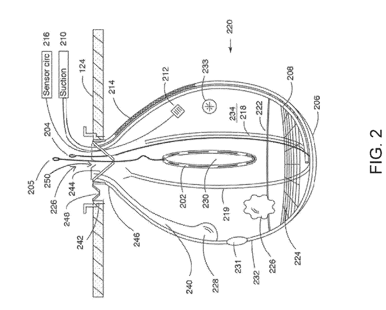 Laparoscopic workspace device