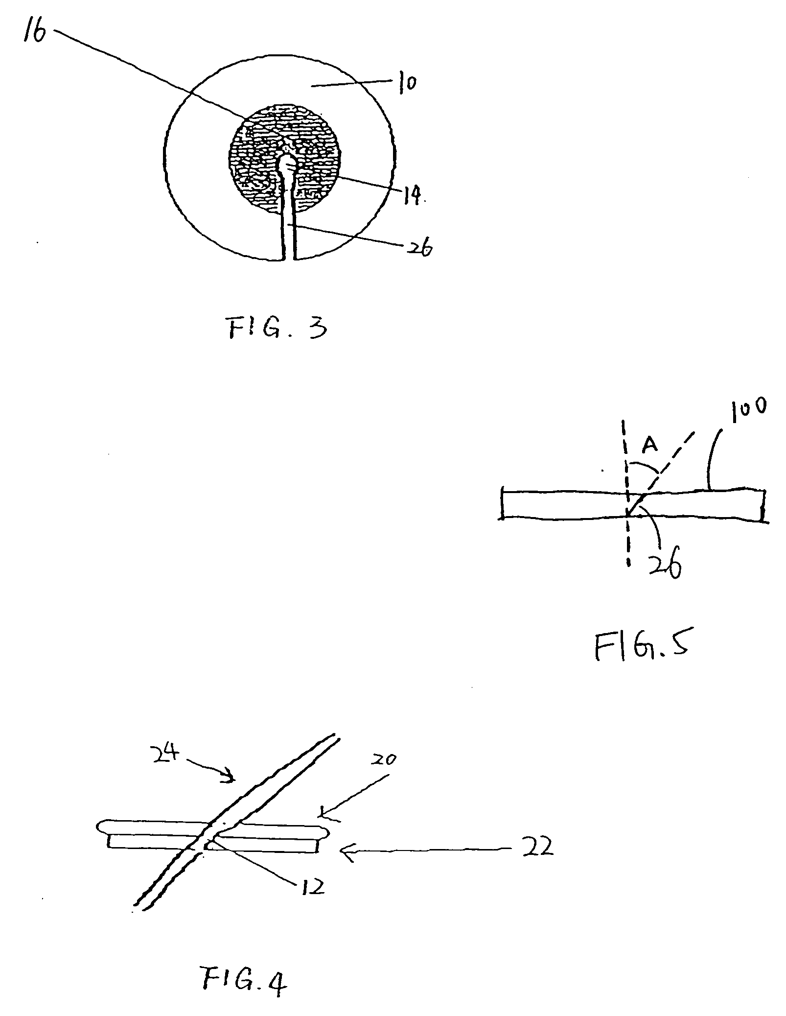 Hemostasis pad and method